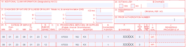 This is an incorrect billing example on the CMS 1500 form when billing the same HCPCS code with identical modifiers.
